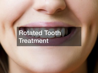 Rotated Tooth Treatment