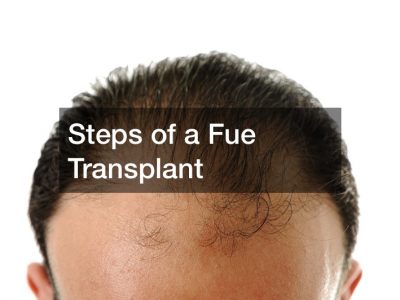 Steps of a Fue Transplant